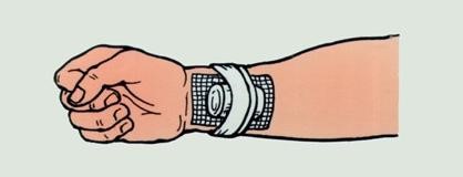 Перевязка грудной клетки бинтом. Тампонада раны и наложение давящей повязки. При каком кровотечении накладывают давящую повязку. Тугая повязка. Тугая повязка алгоритм.